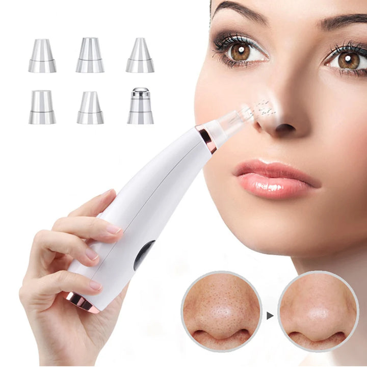 Electric Blackhead Remover Vacuum Acne